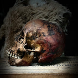 Human skull with mandible