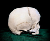 Child dwarf skull