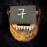 Item 7. A human mandible