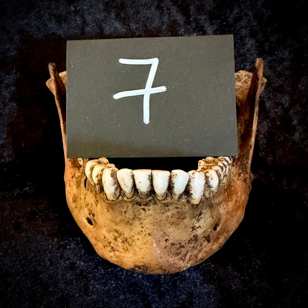 Item 7. A human mandible