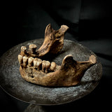 A mandible