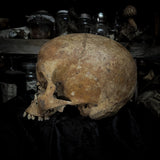 Human skull