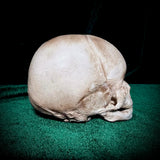 Human fetal skull