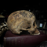 Human skull