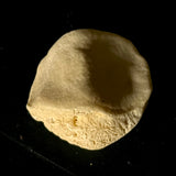 Human Kneecap