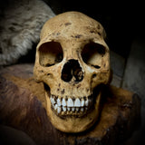 Human skull with mandible