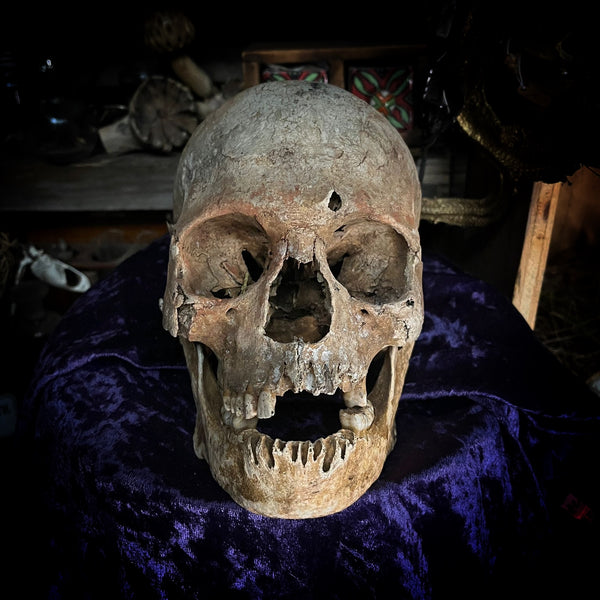 Human skull