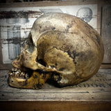 Human skull with mandible