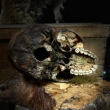 Human skull