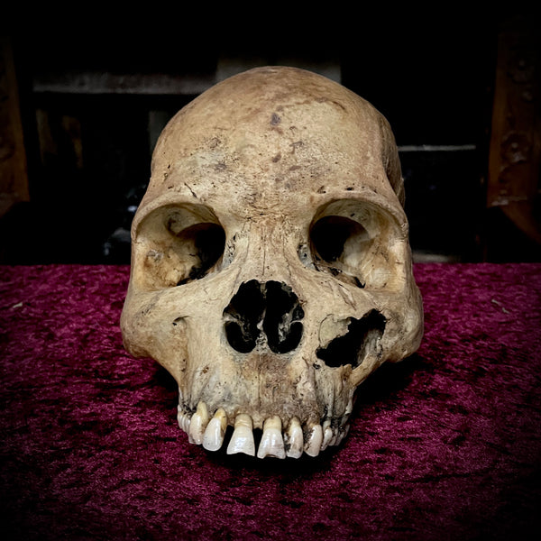 Human skull
