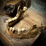 Human skull with mandible