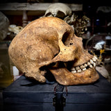 Human skull