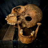 Item 11. Human skull with mandible