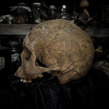 Human skull