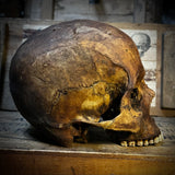 Human skull