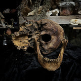 Human skull