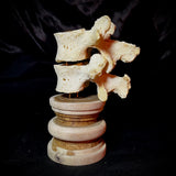 Item 4. Double human vertebrae stand
