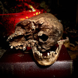 A human skull with mandible