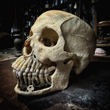 Human skull