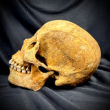 Item 14. Human skull with mandible