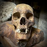 Human skull with mandible
