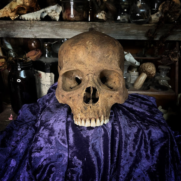 Human skull