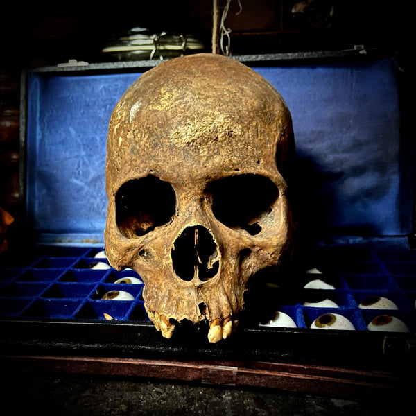 A human skull