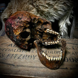Human skull with mandible