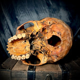 Item 14. Human skull