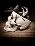 Medically prepared human skull