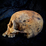 Item 15. Human skull