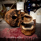Human skull with mandible