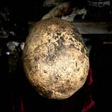 A human skull with mandible