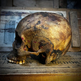 Human skull