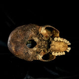 Item 1. Human skull
