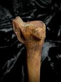 Human tibia (shinbone)