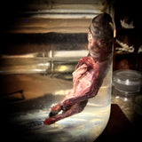 Medically dissected fetal specimen