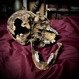 Human skull with mandible
