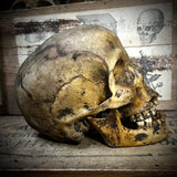 Human skull with mandible