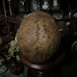 Human skull
