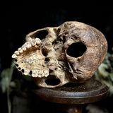 A human skull