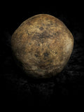 Human skull