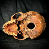 Item 7. Human skull