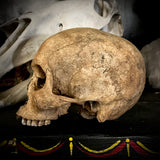 Human skull