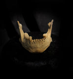 A mandible