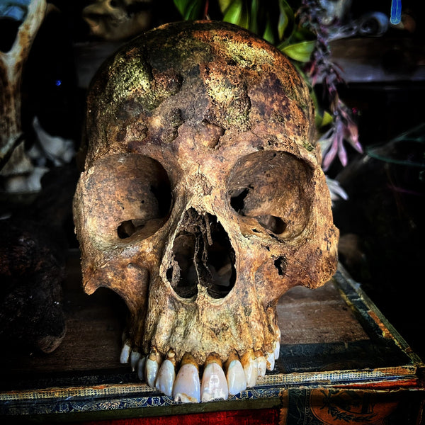 A human skull