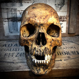 Human skull with mandible