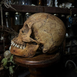 Human skull