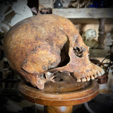 Human skull