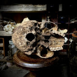 Human skull